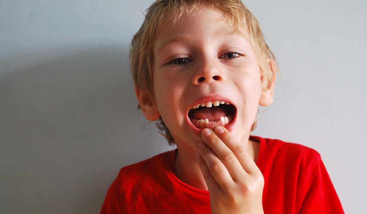 cost of dental implants Melbourne